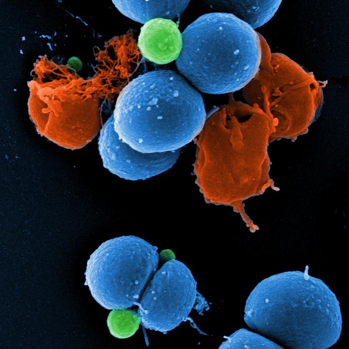 Staphylococcus Aureus - PK 150