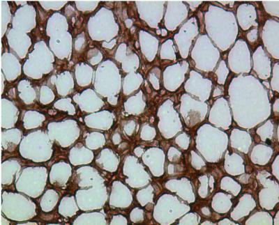 Fat Tissue Regulator