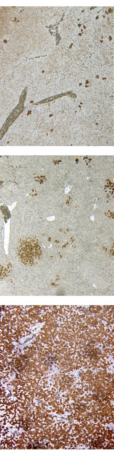 New Chimeric Mouse Model for Human Liver Diseases, Drug Testing