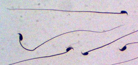 Mouse Sperm Image Eurekalert Science News Releases