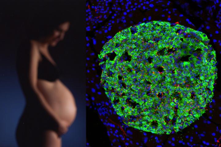 Leptin Inhibits Prenatal Development of Neuronal Connections between Brain and Pancreas