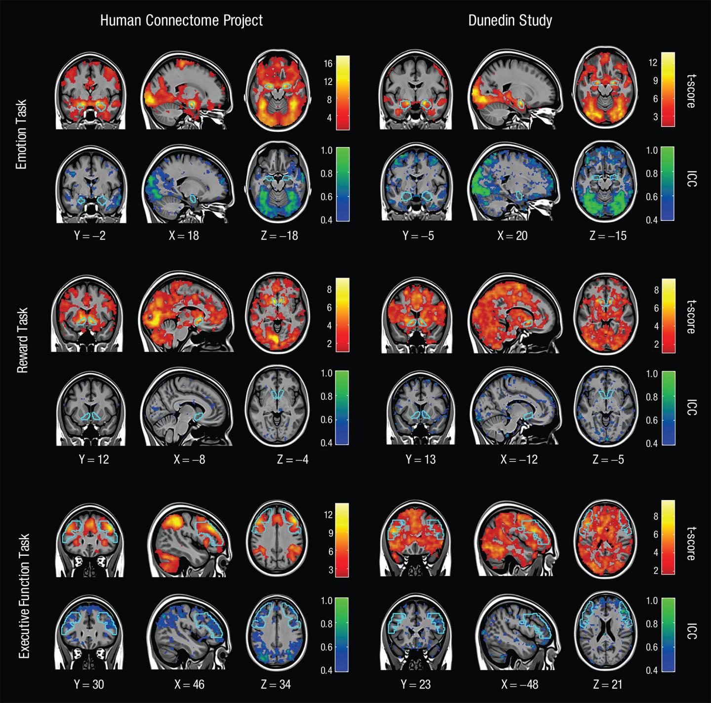 Two Days of fMRI Compared