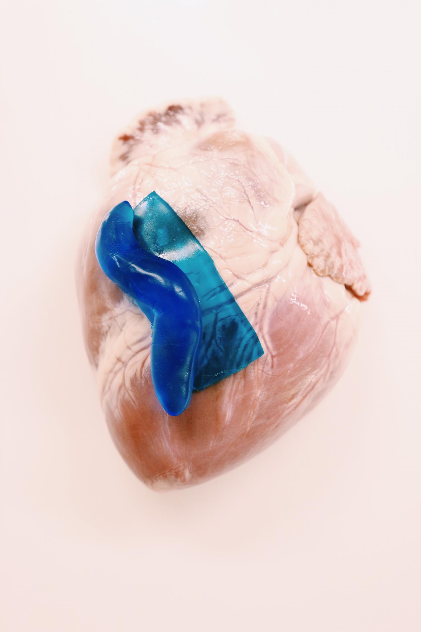 Slug Mucus Inspires New Type of Surgical Glue to Close Wounds