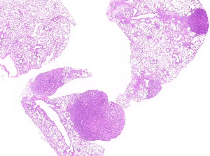 Lung carcinoma induced by KRAS4A.