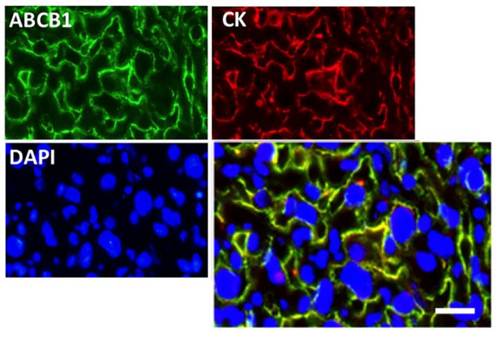 ABCB1 in the Mouse Placenta