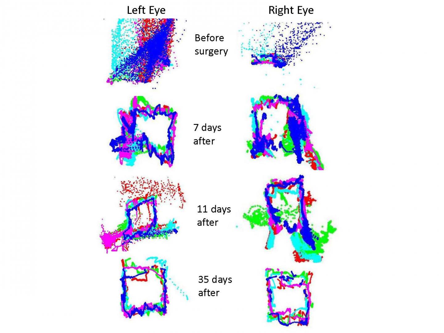 Tracking of Eye Movement to St [IMAGE] | EurekAlert! Science News Releases