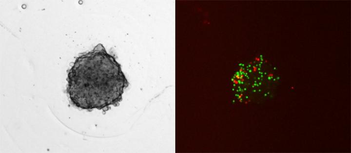 The spheroid includes cancer cells, endothelial cells, fibroblasts, monocytes and human T cells