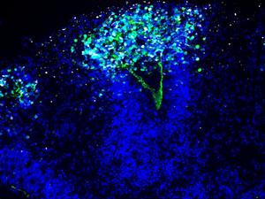 The image shows how the herpes virus (white) spreads into the organoid and destroys the integrity of the neuroepithelium lining the ventricle (nuclei in blue, green marker for the neuroepithelium).