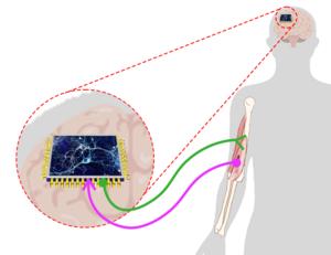 BCIs and regenerative medicine