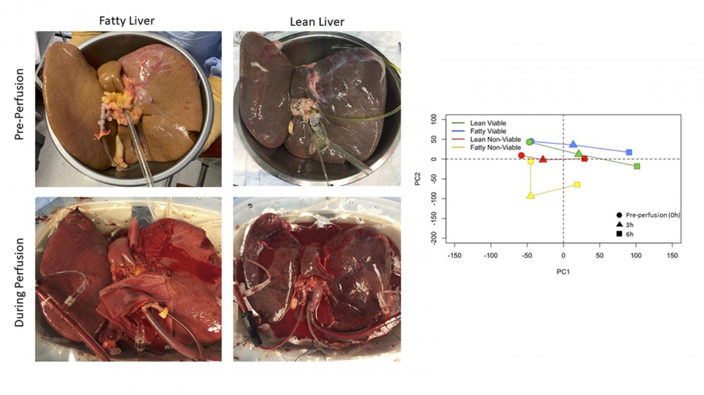 Fatty and lean livers undergoing machine perfusion