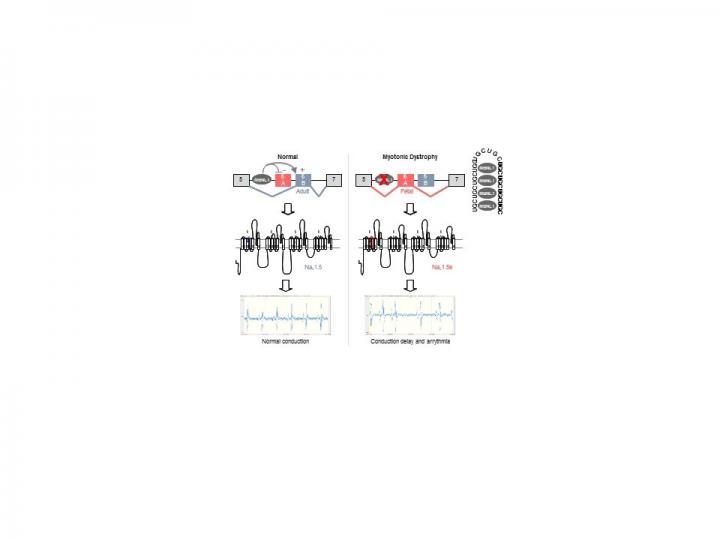 Model of SCN5A splicing alteration in myotonic dystrophy