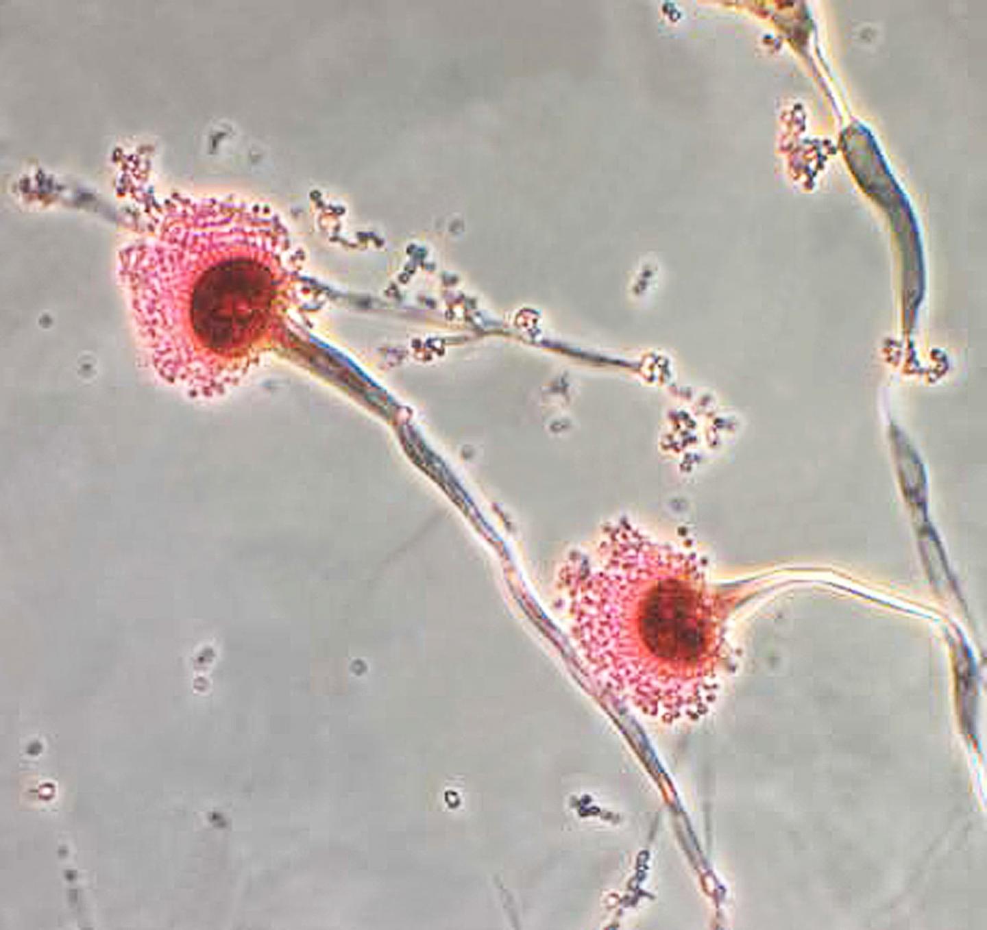 <em>Aspergillus fumigatus</em>