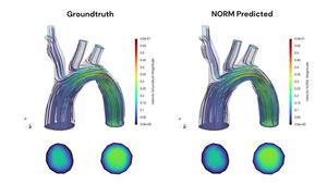 The video comparision between the groundtruth blood flow the result prediced by NORM