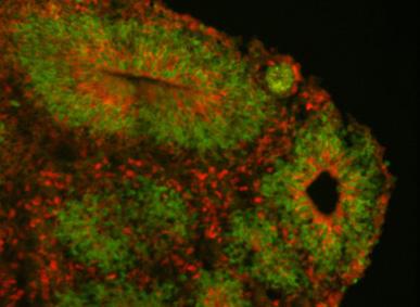 Human Cortical Organoid