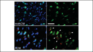 Brain Support Cells Transfer Their Mitochondria to Fight Free Radicals