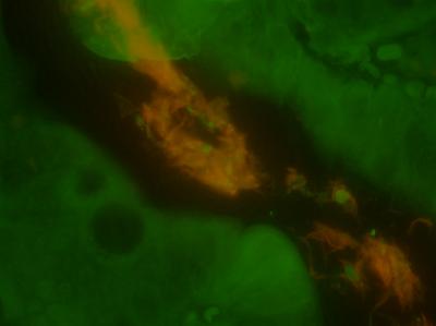 Immune System Helpers in the Gut