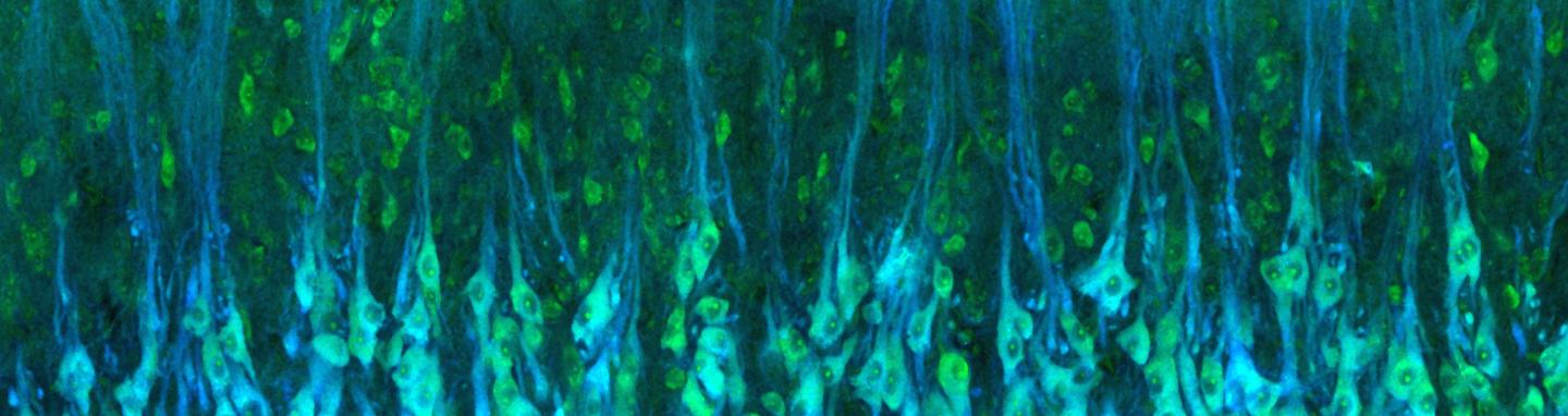 Histology of Turtle Neurons 2