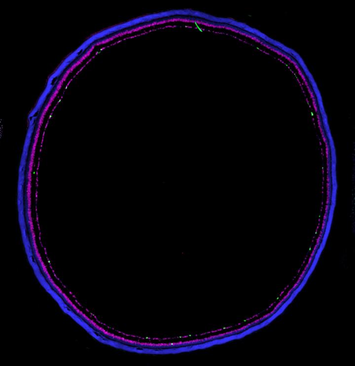 Retinal Section