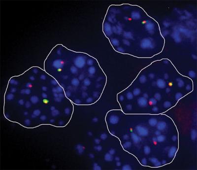 Cells Can Randomly Use One Copy of a Gene Over the Other