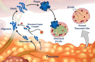 Untangling Untidy Folds to Understand Diseases