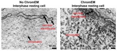 Chromatin with and without ChromEM Dye
