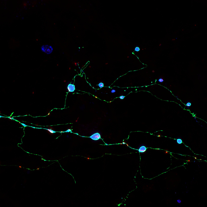Scripps Research discovery illuminates how brain cells die in prion diseases