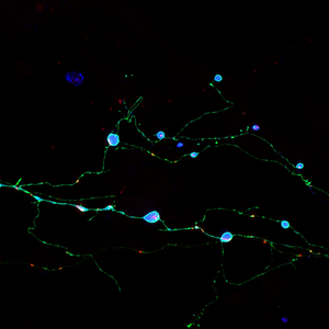 Scripps Research Discovery Illuminates How Br | EurekAlert!