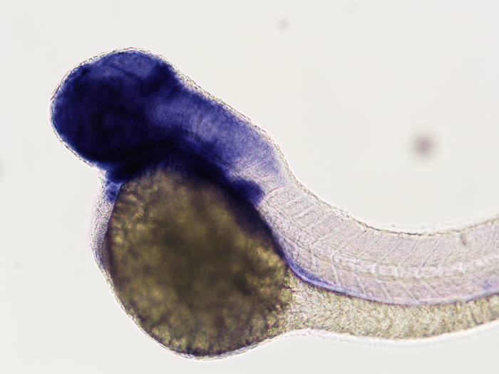 Zebrafish also have the SHROOM4 gene.