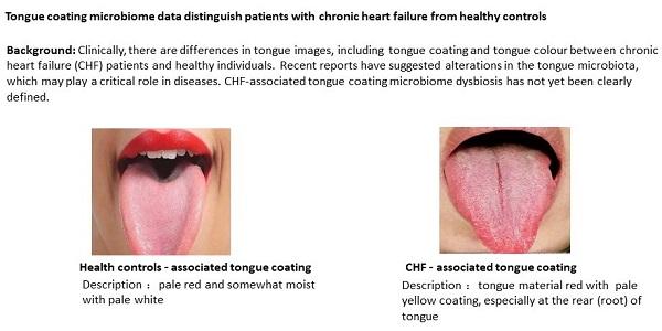 Healthy Controls vs CHF Tongues