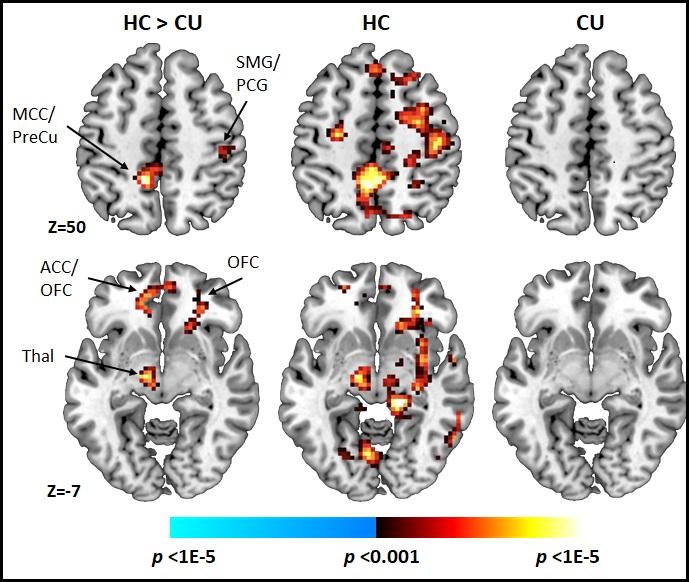 Conflict-Related Neural Activations
