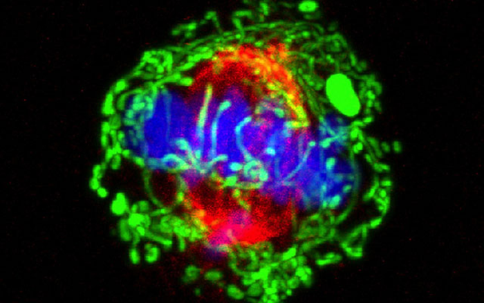 Dividing Breast Cancer Cell