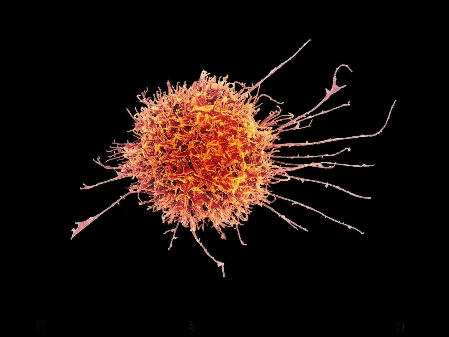 Scanning Electron Micrograph of a Human Natural Killer Cell, a Type of Immune Cell