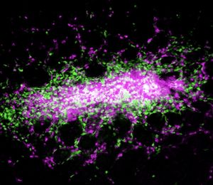 Bacterial control in the intestines