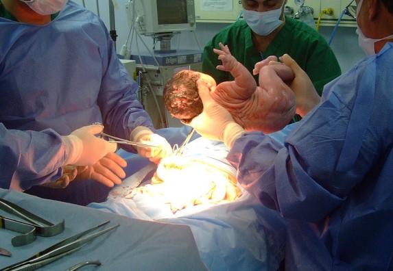 Why Mothers in Mainland China, Hong Kong and Taiwan Choose Cesarean Delivery