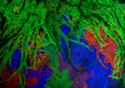 Dominant Cell Clones Make Most of Heart Muscle