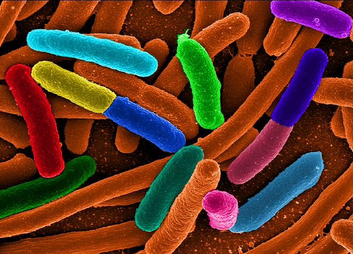 Diverse <i>E. coli</i>