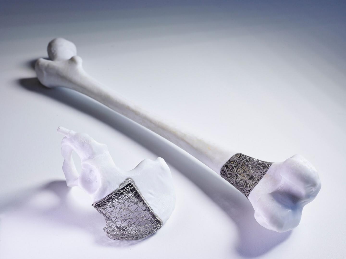 3D-Printed Element Inserted into Bone. #2
