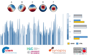 The five cerebral microstates measured by an EEG