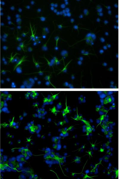 Potential Pathway for Drug Intervention