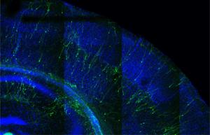 Mouse cortex transplanted with human neurons