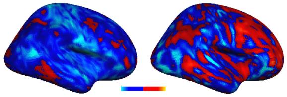 Researchers Discover 'Idiosyncratic' Brain Patterns in Autism