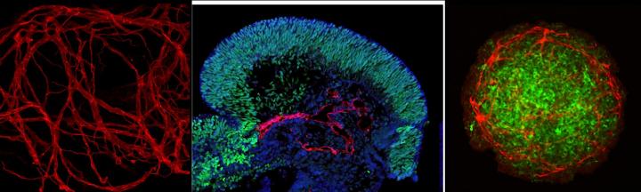 Organoid Models