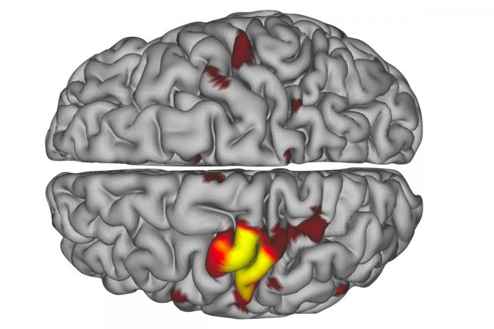 Spontaneous brain pulses