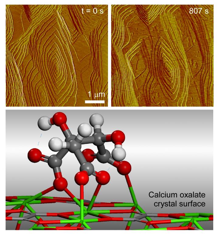 Inhibitor for Kidney Stones