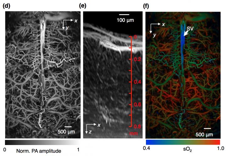 Fast Functional Photoacoustic Microscopy