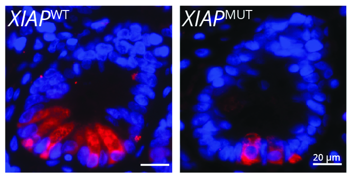 XIAP gene