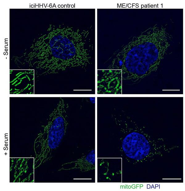 Cultured HHV-6 Cells, University of California San Diego