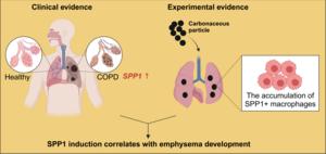 Environmental particle pollution exposure contributes to chronic lung disease development