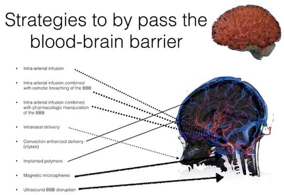Delivery Strategies of Chemotherapy to the Central Nervous System