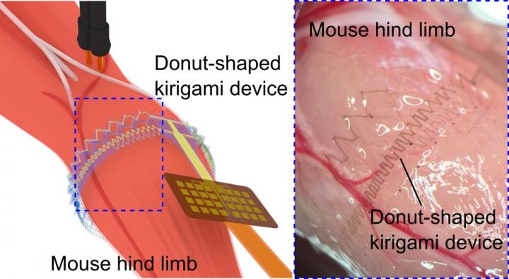 EMG Signal Recording Form the Hind Limb of a Mouse Using the Donut-Shaped Kirigami Device